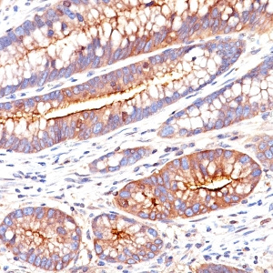 Carcinoembryonic Antigen (CEA) / CD66; Clone SPM551 (Concentrate)